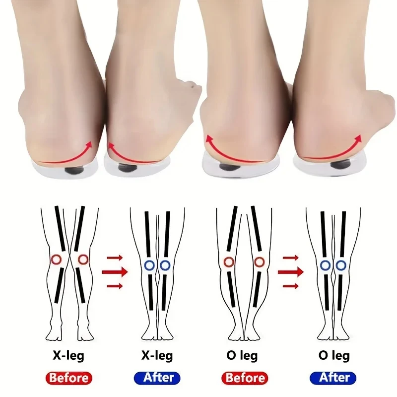 1Pair Orthopedic Insoles for F - Women Shoes Types review and price