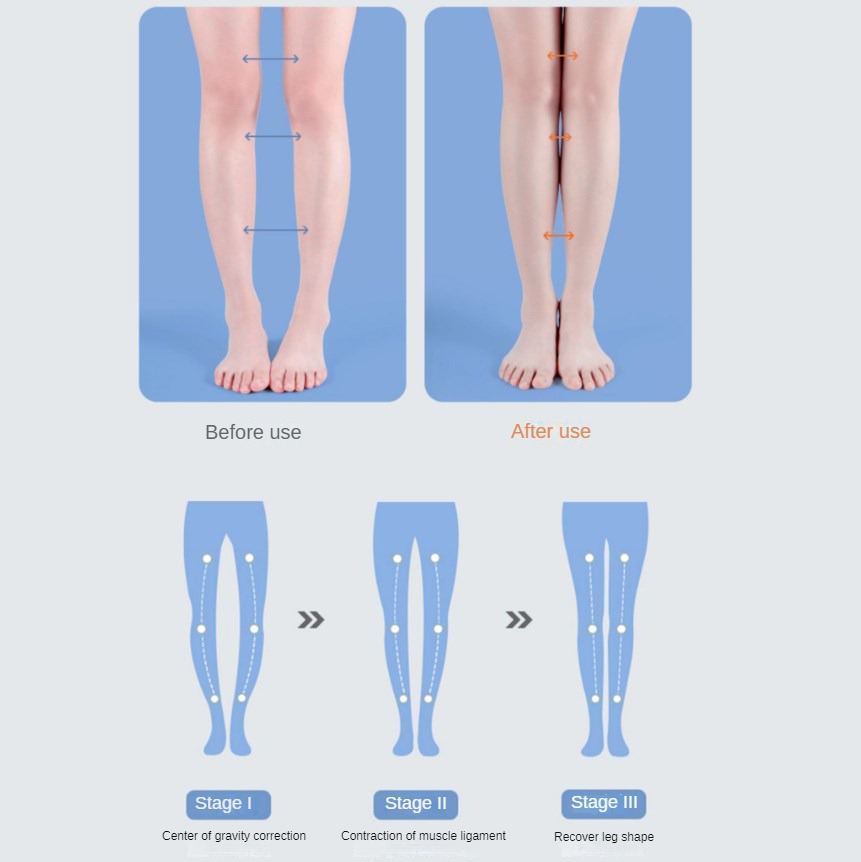 PU Orthotic Insole Arch Suppor - Women Shoes Types review and price